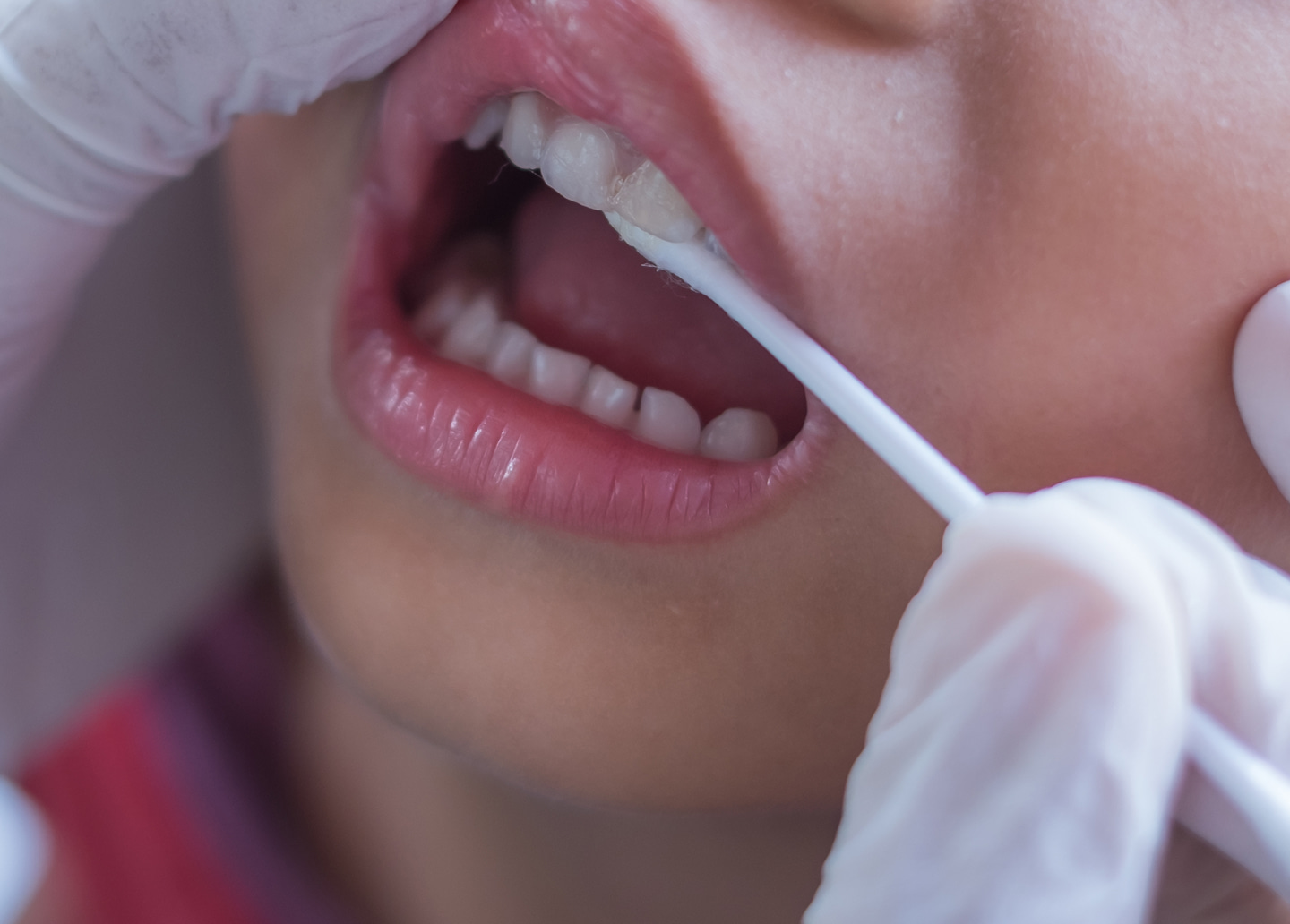 Fluoride treatments help protect children's teeth from cavities and strengthen ename