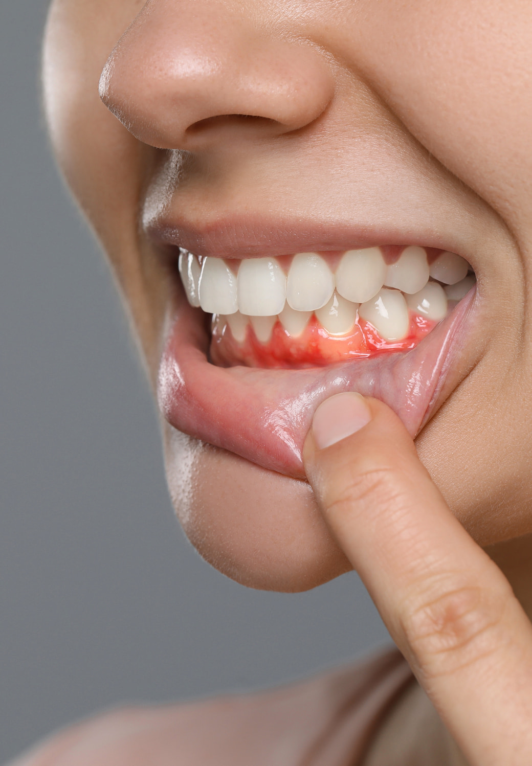 Gum Disease Treatment Banner Image