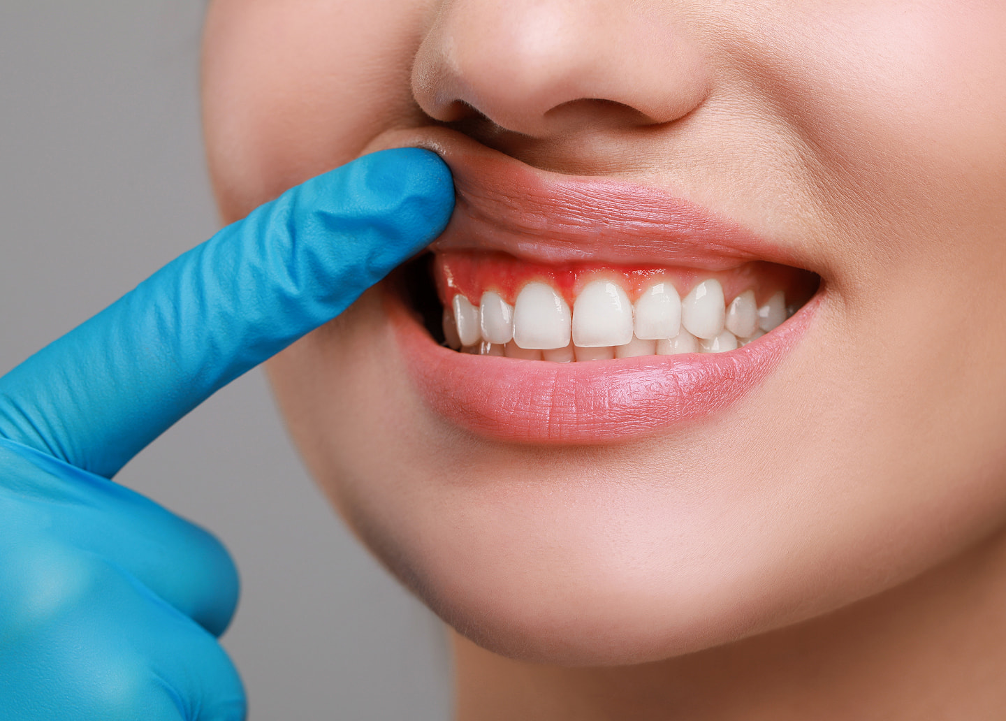 Aftercare instructions and healing tips following scaling and root planing for gum health