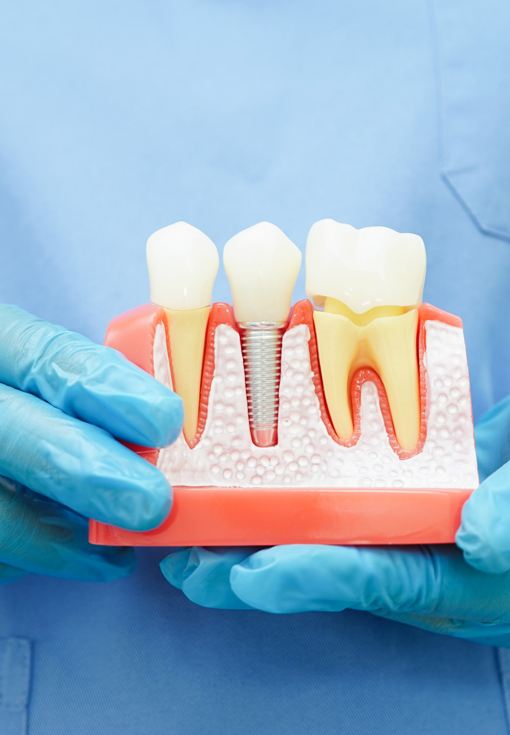 Implant Consultation 3d Imaging Banner Image