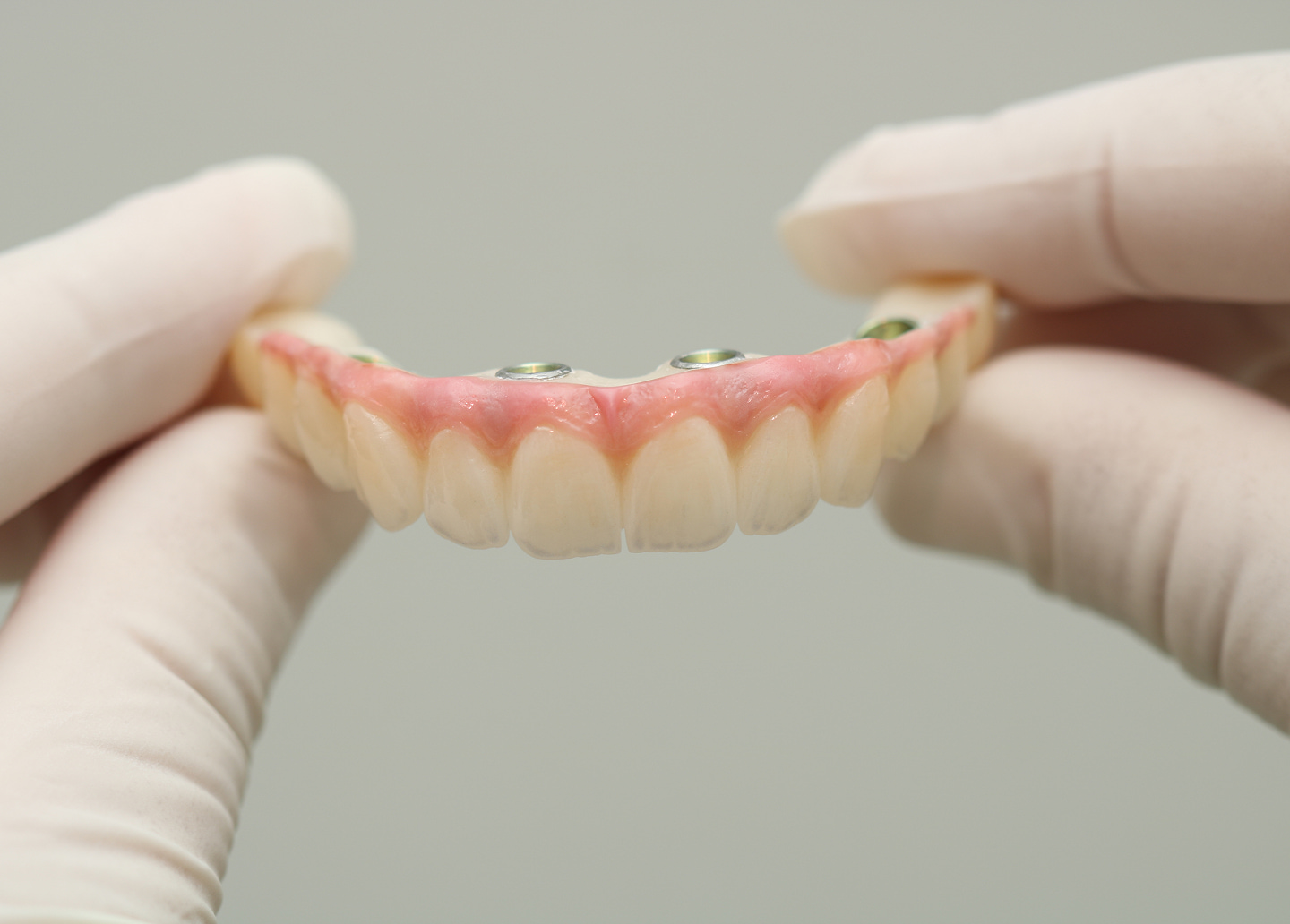 Implant dentures securely snap onto dental implants for stability and comfort