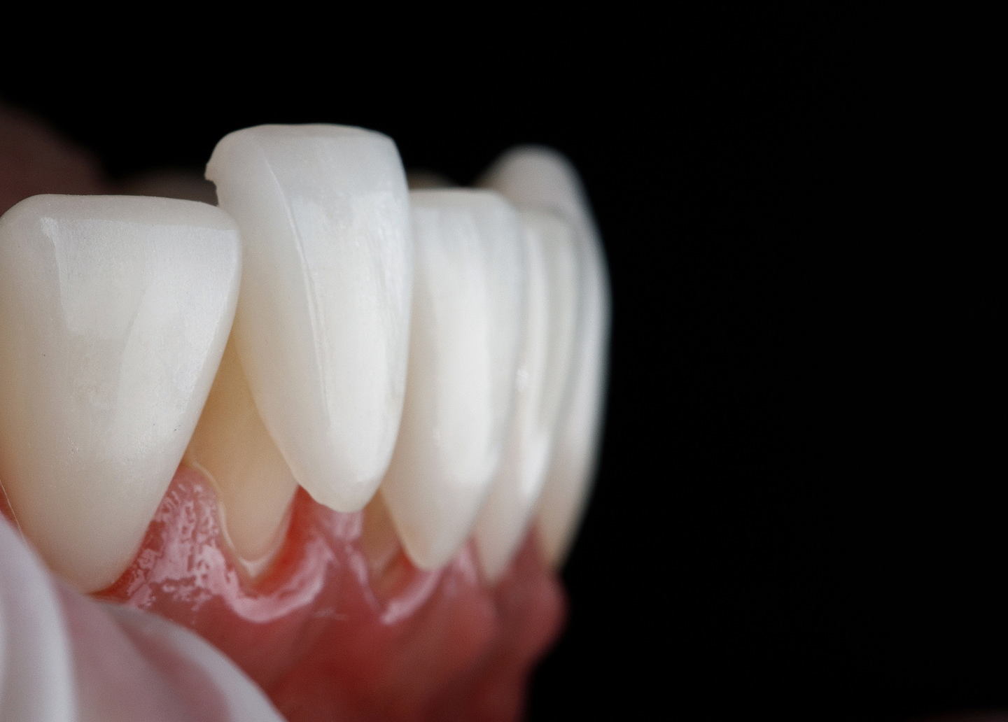 Proper daily care and maintenance tips for porcelain veneers