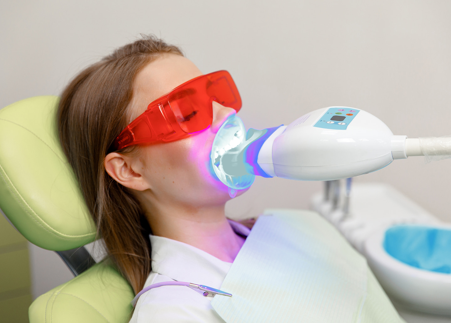 Benefits of professional teeth whitening for safe, effective stain removal